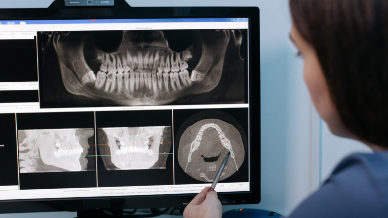 Digital X-Rays near Sylvan Grove, KS